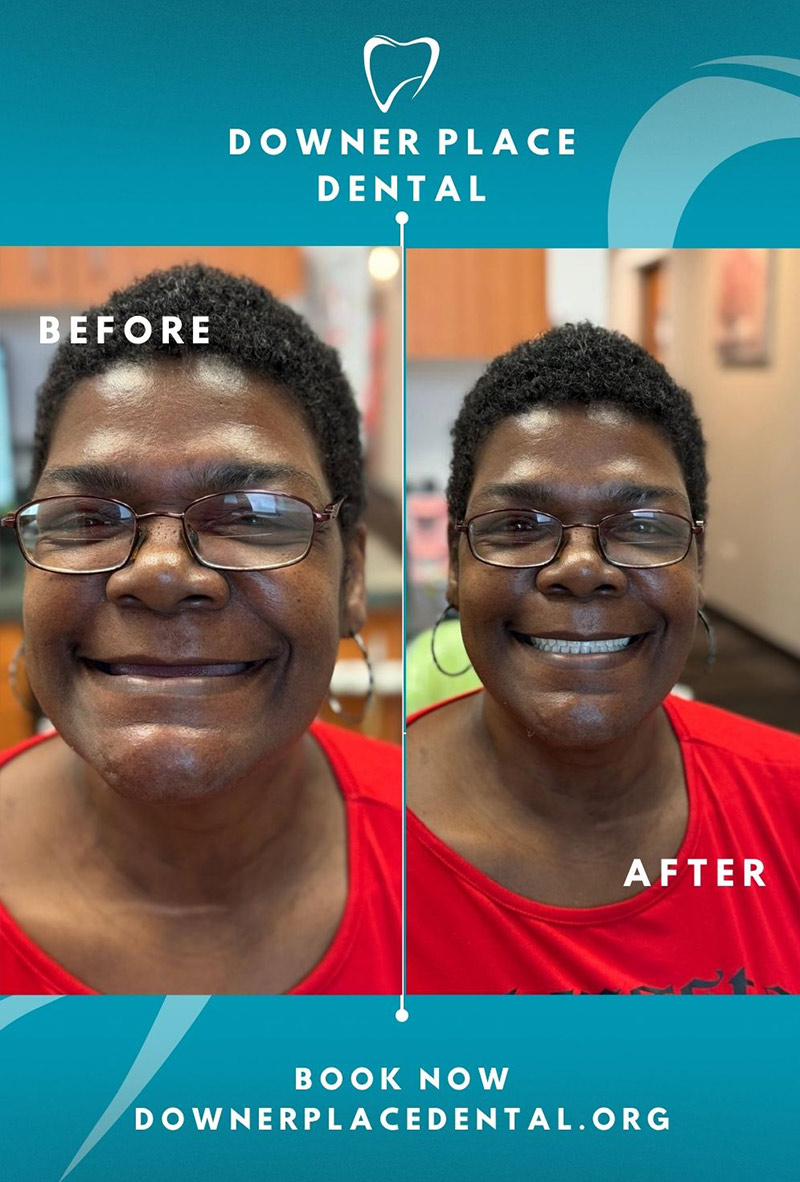 Before and After